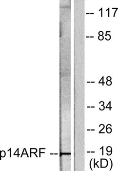 p14 rabbit pAb Antibody