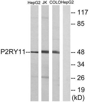 P2Y11 rabbit pAb Antibody