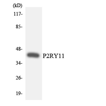 P2Y11 rabbit pAb Antibody