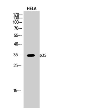 p35 rabbit pAb Antibody