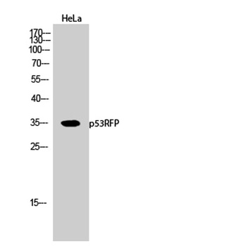 p53RFP rabbit pAb Antibody