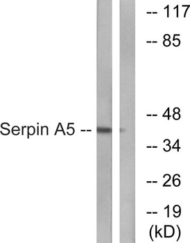PAI-3 rabbit pAb Antibody