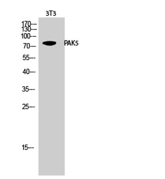 PAK5 rabbit pAb Antibody