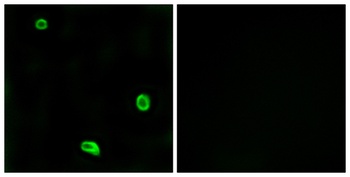 PAR-4 rabbit pAb Antibody