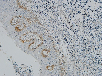 Pax-8 rabbit pAb Antibody