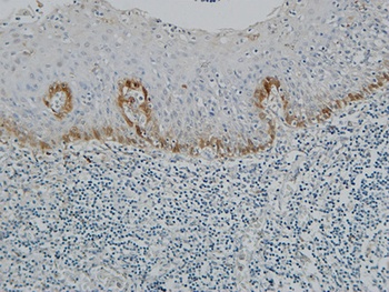 Pax-8 rabbit pAb Antibody