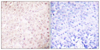 PCAF rabbit pAb Antibody