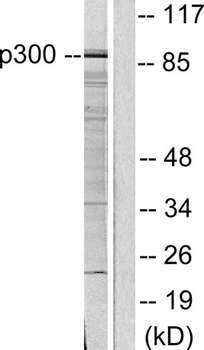 PCAF rabbit pAb Antibody