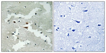 Pdcd-4 rabbit pAb Antibody