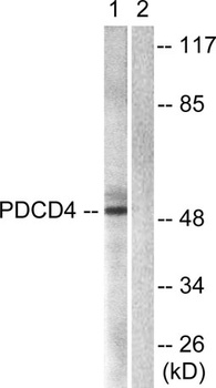 Pdcd-4 rabbit pAb Antibody