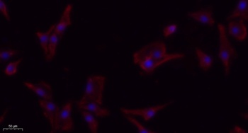 PDGFR-β rabbit pAb Antibody