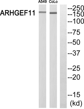 PDZ-RhoGEF rabbit pAb Antibody