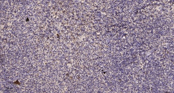 PDZ-RhoGEF rabbit pAb Antibody