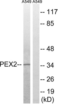 Peroxin 2 rabbit pAb Antibody