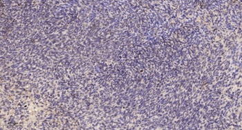 Peroxin 3 rabbit pAb Antibody