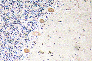 PFKM rabbit pAb Antibody
