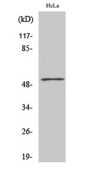 PFK-2 liv/tes rabbit pAb Antibody