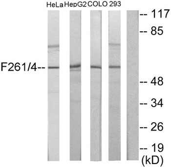 PFK-2 liv/tes rabbit pAb Antibody