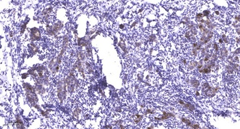 PFK-2 liv/tes rabbit pAb Antibody