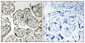 PI 3-kinase p85α rabbit pAb Antibody