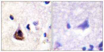 PI 3-kinase p85α rabbit pAb Antibody