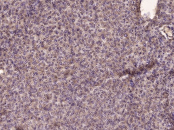 PI 3-kinase p85β rabbit pAb Antibody