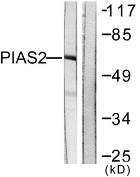 PIASx rabbit pAb Antibody