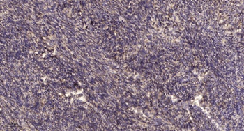 PIASx rabbit pAb Antibody