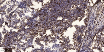 pICln rabbit pAb Antibody