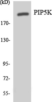PIP5KIII rabbit pAb Antibody