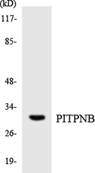 PITPβ rabbit pAb Antibody