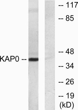 PKA Iα reg rabbit pAb Antibody