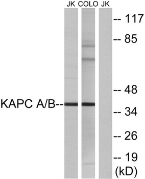 PKAα/β cat rabbit pAb Antibody