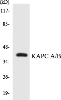PKAα/β cat rabbit pAb Antibody