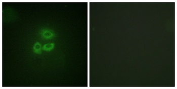 PKD1 rabbit pAb Antibody