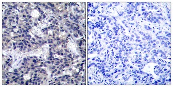 PKR rabbit pAb Antibody