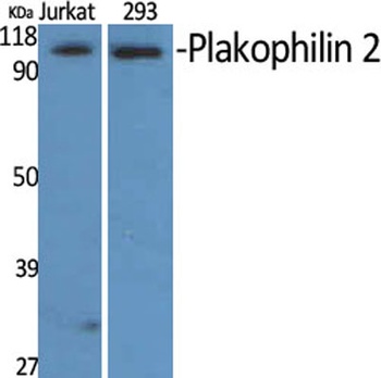 Plakophilin 2 rabbit pAb Antibody