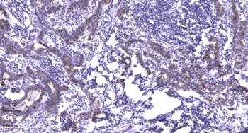 Plakophilin 2 rabbit pAb Antibody
