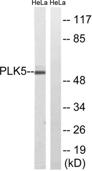 PLK-5 rabbit pAb Antibody
