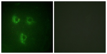 PMEPA1 rabbit pAb Antibody