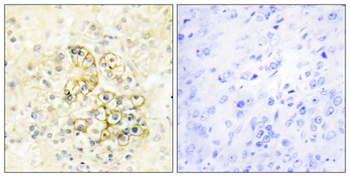 PMEPA1 rabbit pAb Antibody