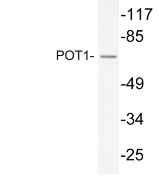 POT1 rabbit pAb Antibody