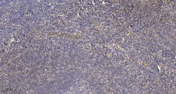 POT1 rabbit pAb Antibody