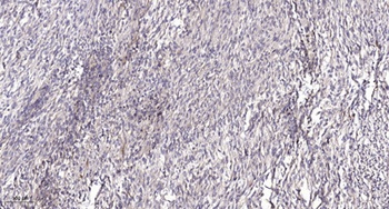 PP32R1 rabbit pAb Antibody