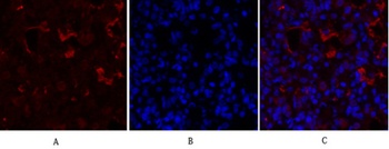 PPAR-γ rabbit pAb Antibody