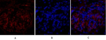 PPAR-γ rabbit pAb Antibody