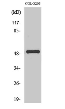 PPP4R1L rabbit pAb Antibody