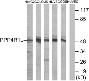 PPP4R1L rabbit pAb Antibody