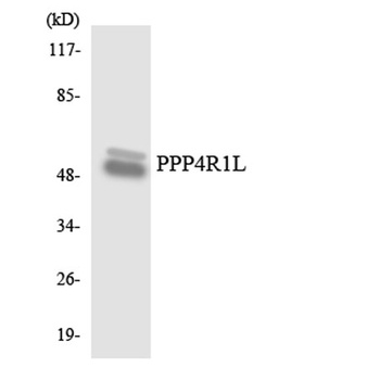PPP4R1L rabbit pAb Antibody
