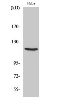 PR rabbit pAb Antibody